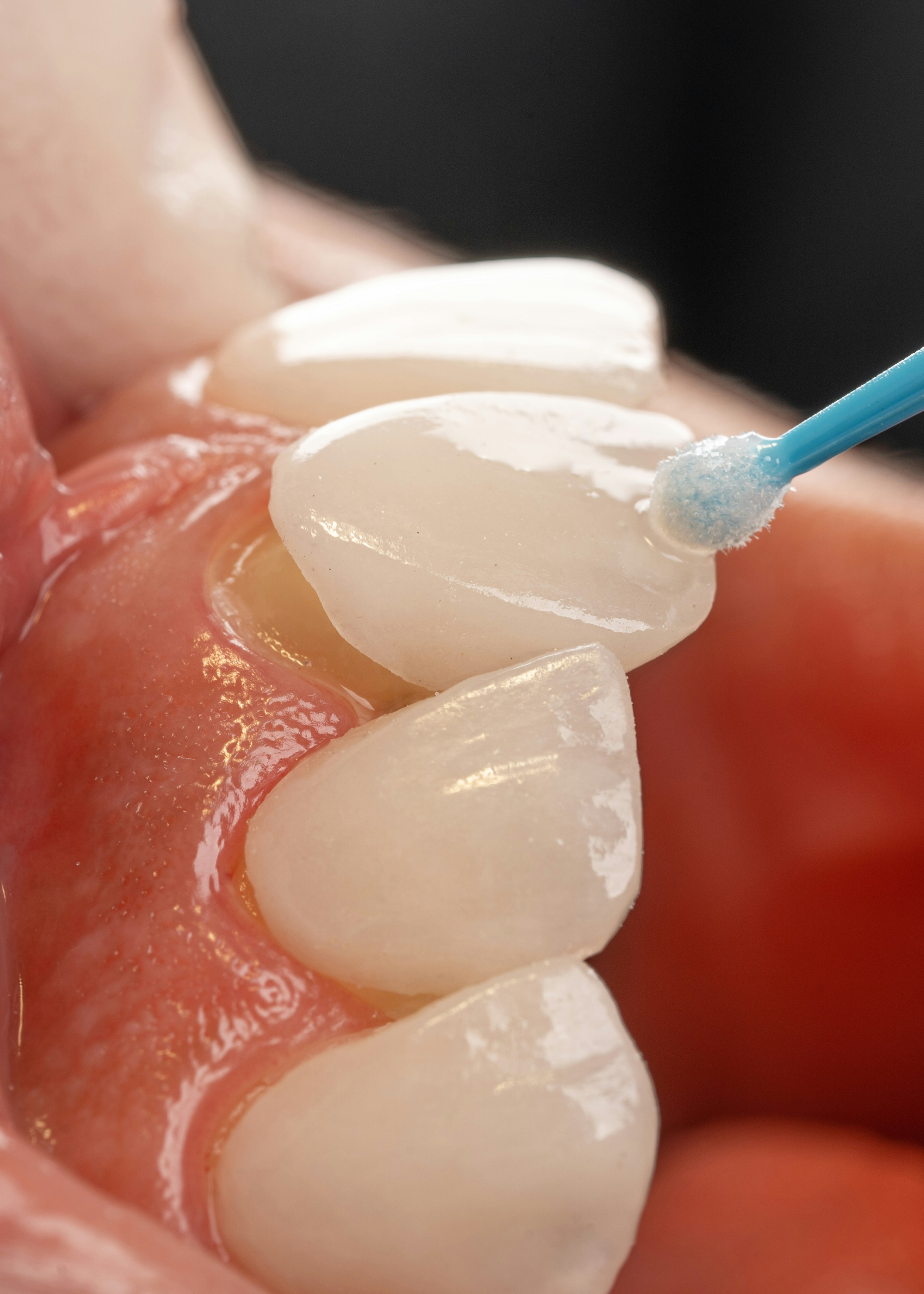 Tendencias en Estética Dental
