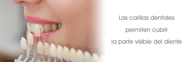 Odontología restauradora